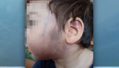 S&uacute;lyosan b&aacute;ntalmazhattak egy m&aacute;sf&eacute;l &eacute;ves kisfi&uacute;t a szeksz&aacute;rdi gyermekotthonban